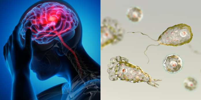 Dangerous brain-eating amoeba