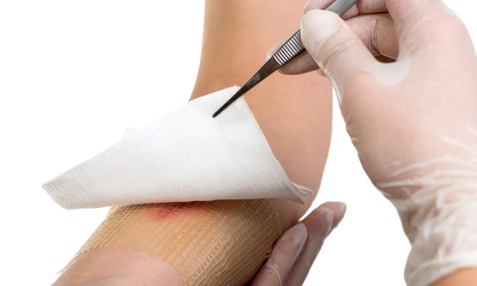 جلے زخموں کے علاج کیلئے حیرت انگیز پٹی تیار کر لی گئی