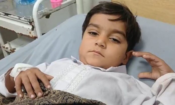 رحیم یار خان میں انوکھی سرجری ،بچے کے سینے سے ’بغیر سر والا بچہ‘ نکال لیا گیا